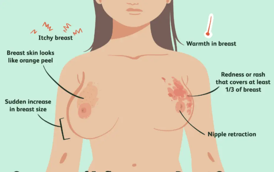 breast-cancer